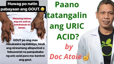 Doc Atoie Arboleda (@docatoieph) .